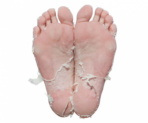 Exfoliating Foot Peel Mask